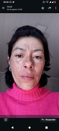 Resultado de cliente Face Clean
