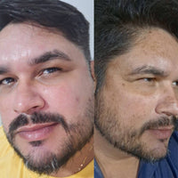 Resultado de cliente Face Clean