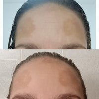 Resultado de cliente Face Clean