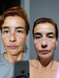 Resultado de cliente Face Clean