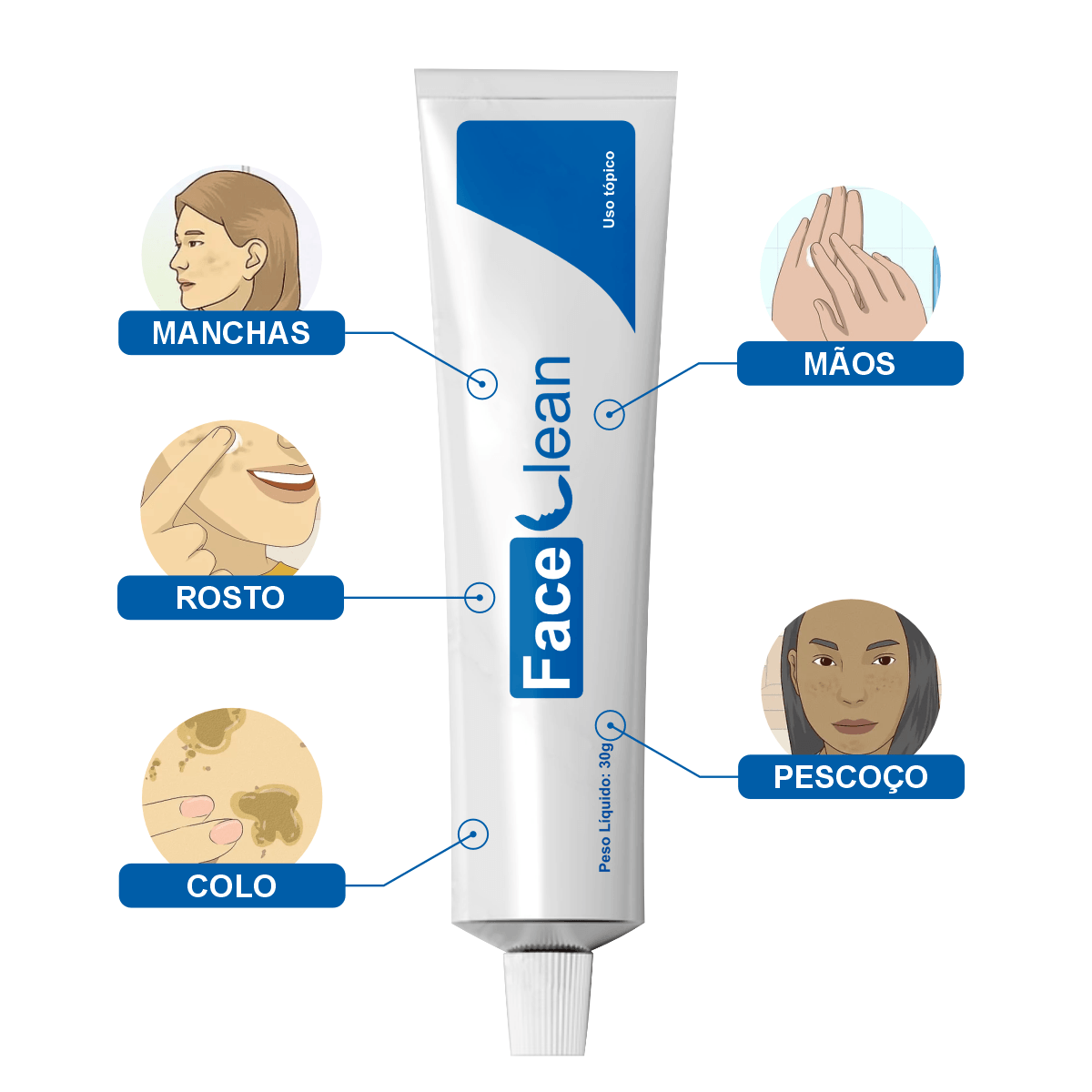 Face Clean Creme Clareador de Pele Contra Manchas e Melasma – Face ...