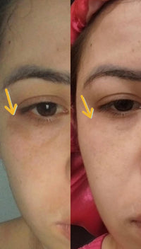Resultado de cliente Face Clean