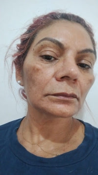 Resultado de cliente Face Clean
